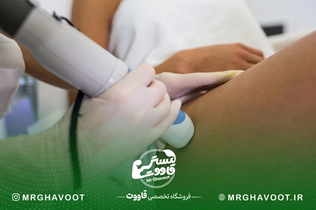 لیزر درمانی واریس در بارداری