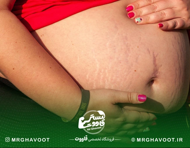 ترک بارداری